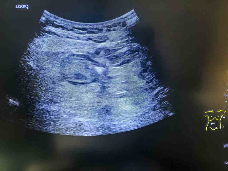Ultrasound Case 1