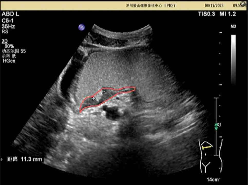 Ultrasound Case 2
